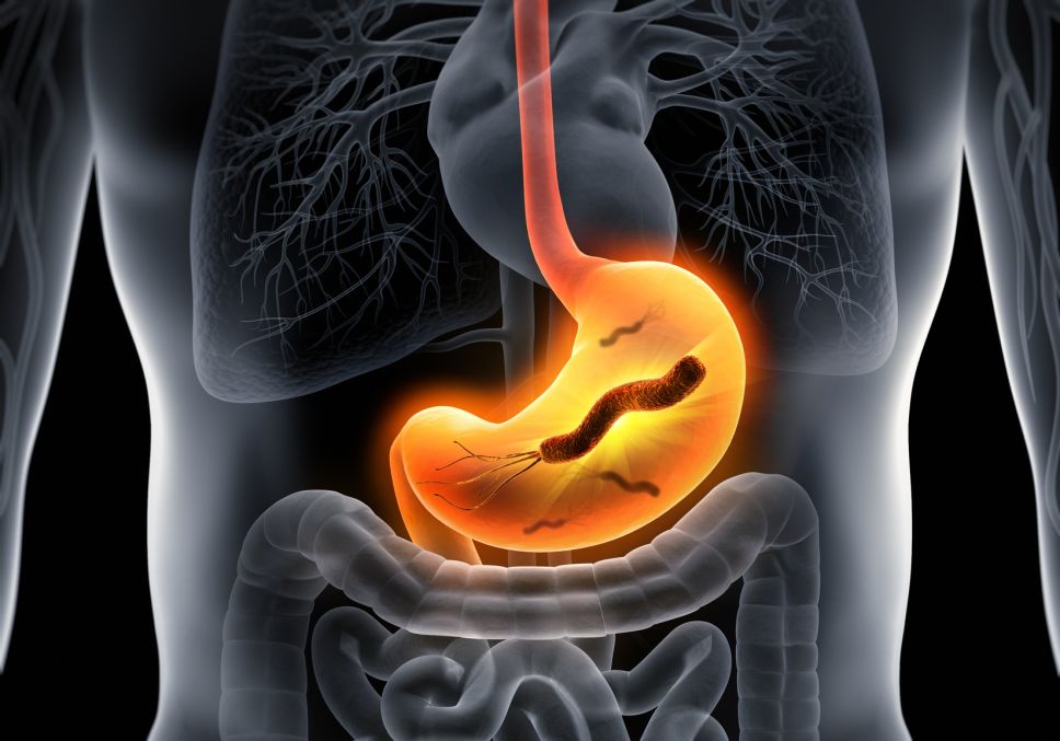 ORGÀNIC A EN CONSTRUCCIÓ: helicobacter pylori